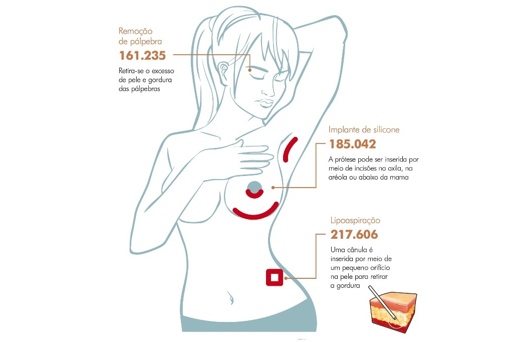 Cirurgias Plásticas Mais Procuradas